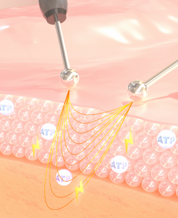 Eve Injection EVE – Non Surgical Treatments