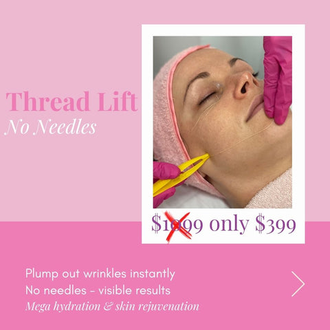 THREAD LIFT NO NEEDLES