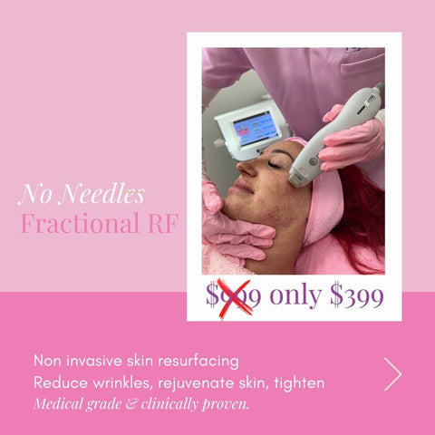NO NEEDLES FRACTIONAL RF
