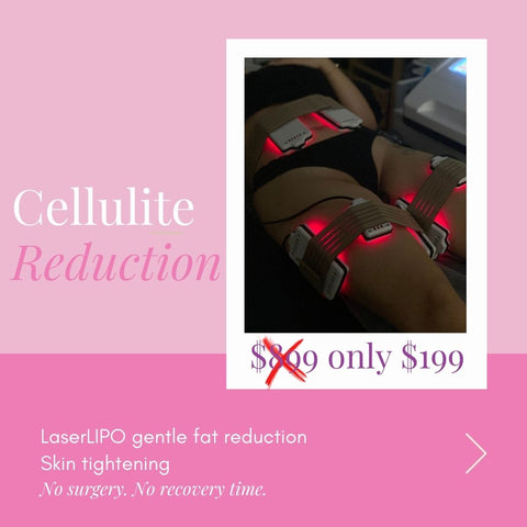 CELLULITE REDUCTION
